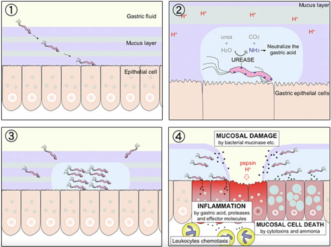 H. Pylori diagram